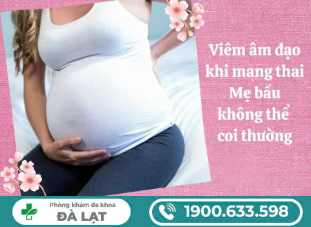 Hình ảnh minh họa